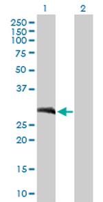 LOR Antibody in Western Blot (WB)