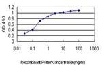 LTBP2 Monoclonal Antibody (5D7)