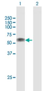 LTBR Polyclonal Antibody, MaxPab™
