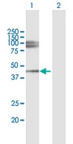 LUM Polyclonal Antibody, MaxPab™