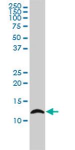LY6H Antibody in Western Blot (WB)