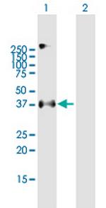 EPCAM Antibody in Western Blot (WB)