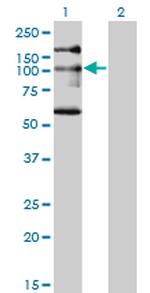 NBR1 Antibody in Western Blot (WB)