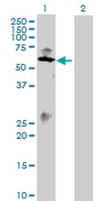 SMAD1 Polyclonal Antibody, MaxPab™