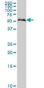 SMAD1 Monoclonal Antibody (2E9)