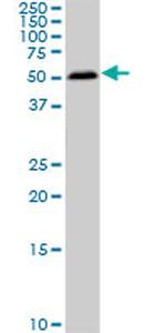 SMAD1 Antibody in Western Blot (WB)