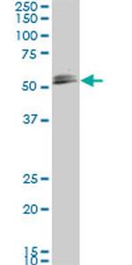 SMAD1 Antibody in Western Blot (WB)