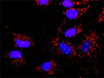 SMAD2 Monoclonal Antibody (4D4)