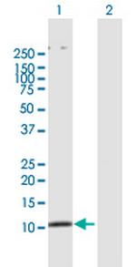 SMAD3 Antibody in Western Blot (WB)