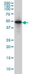 SMAD3 Monoclonal Antibody (1C11)