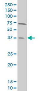 SMAD3 Monoclonal Antibody (1D6)