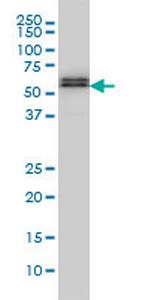 SMAD5 Monoclonal Antibody (2D7)