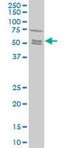 SMAD5 Antibody in Western Blot (WB)