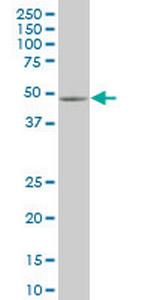 SMAD5 Monoclonal Antibody (1C1)