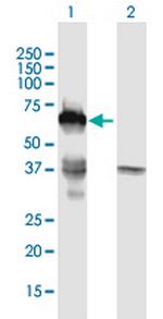 SMAD6 Polyclonal Antibody, MaxPab™