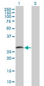 SMAD9 Antibody in Western Blot (WB)