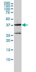MAGEA2 Monoclonal Antibody (1H4)