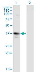 MAGEA3 Monoclonal Antibody (6D10)