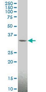 MAGEA4 Monoclonal Antibody (3D12)