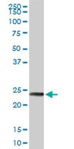 MAGEA8 Antibody in Western Blot (WB)