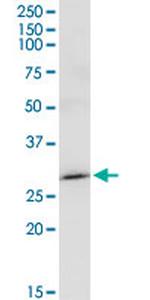 MAGEA8 Antibody in Western Blot (WB)