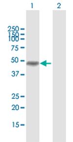 MAGEA8 Polyclonal Antibody, MaxPab™