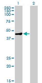 MAGEA9 Polyclonal Antibody, MaxPab™