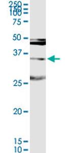 MAGEA9 Antibody in Western Blot (WB)
