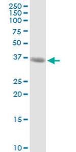 MAGEA9 Antibody in Western Blot (WB)