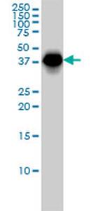 MAGEA9 Antibody in Western Blot (WB)