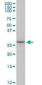 MAGEA12 Monoclonal Antibody (3A10)