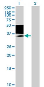 MAGEB1 Polyclonal Antibody, MaxPab™
