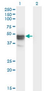 MAGEB1 Monoclonal Antibody (3C1)