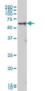 MAK Monoclonal Antibody (4E9)