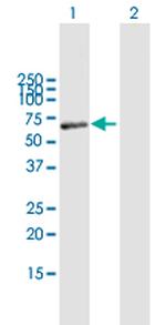 MAOB Antibody in Western Blot (WB)
