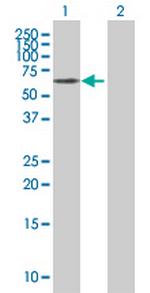 MAP2 Antibody in Western Blot (WB)
