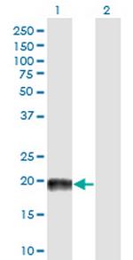 MAP4 Monoclonal Antibody (7C9)