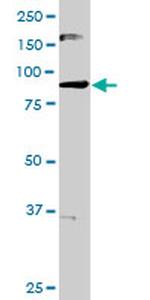 MARK3 Antibody in Western Blot (WB)