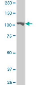 MARS Antibody in Western Blot (WB)