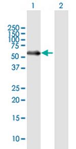 MATN1 Polyclonal Antibody, MaxPab™
