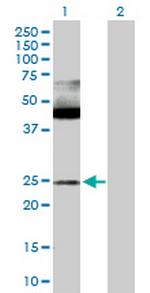 MAX Antibody in Western Blot (WB)