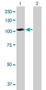 MCC Polyclonal Antibody, MaxPab™
