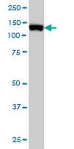 MCM2 Antibody in Western Blot (WB)