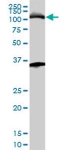 MCM3 Antibody in Western Blot (WB)