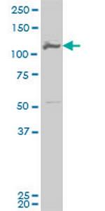 MCM3 Monoclonal Antibody (2A11)