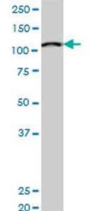 MCM3 Antibody in Western Blot (WB)