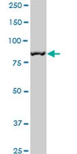 MCM5 Antibody in Western Blot (WB)