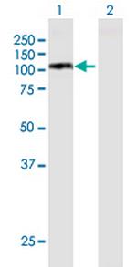 MCM6 Antibody in Western Blot (WB)