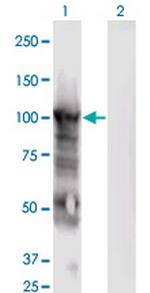 MCM6 Monoclonal Antibody (7D8)