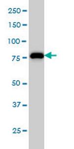 MCM7 Antibody in Western Blot (WB)